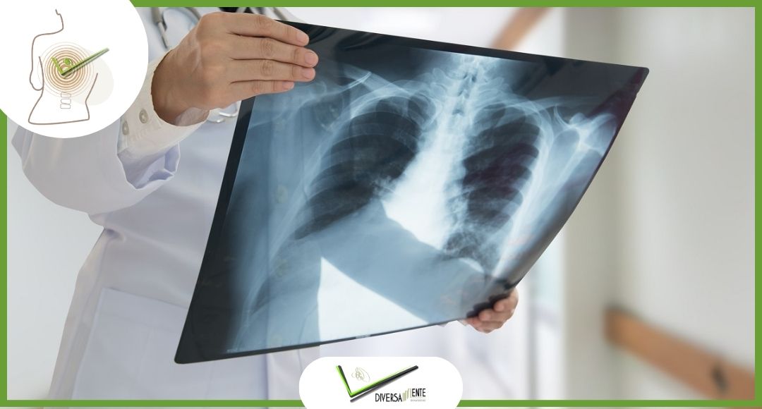 Non diventare una vittima delle immagini radiografiche!